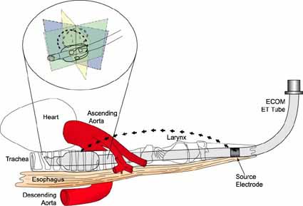 ECOM device image